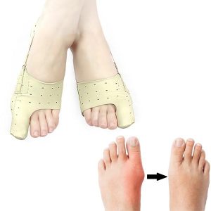 ToeCorrect elastische hallux valgus corrector
